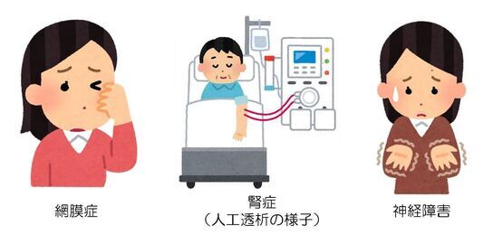 イラスト:糖尿病による三大合併症