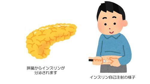 イラスト:インスリン