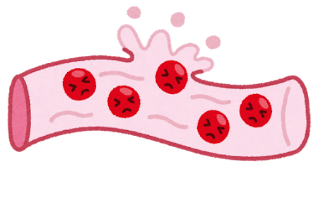 body_kekkan_syukketsu.png