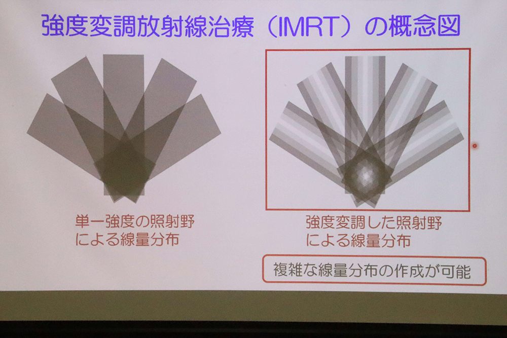 最先端放射線治療の概念