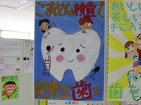 歯の健康ポスター展4
